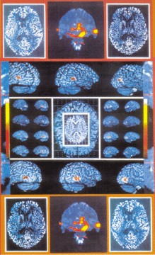 brain images