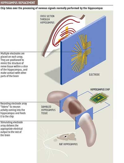 picture of hippocampus replacement